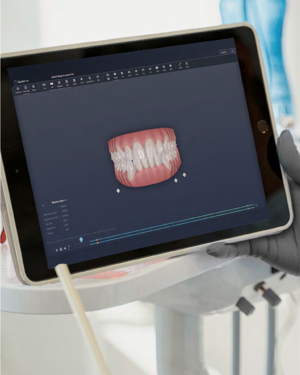 La doctora revisa en una tablet la planificación digital en 3D del movimiento de los dientes